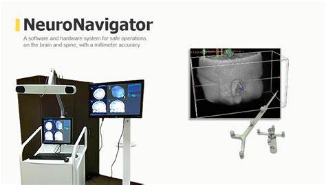 Neuronav: Operating System for Robot Vision