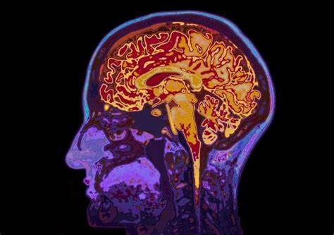 Our brains reveal our choices before we're even aware of them