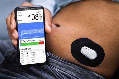 Continuous Glucose Monitoring