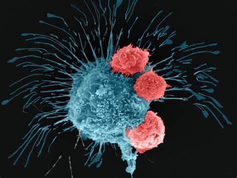 Scientists 3D print tumors for cancer research