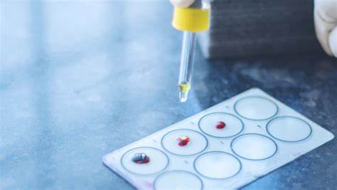 'Gwada negative': French scientists find new blood type in woman