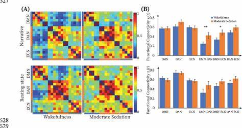 Responsiveness variability during anaesthesia and differences in brain structure