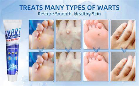 You Want Technology with Warts