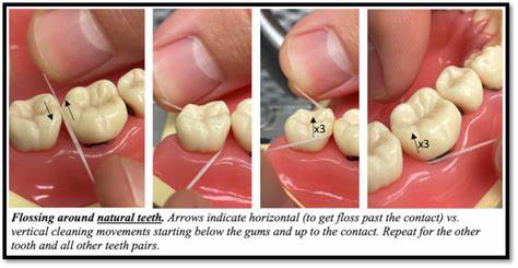 The right thing for the wrong reasons: FLOSS doesn't imply security (2022)