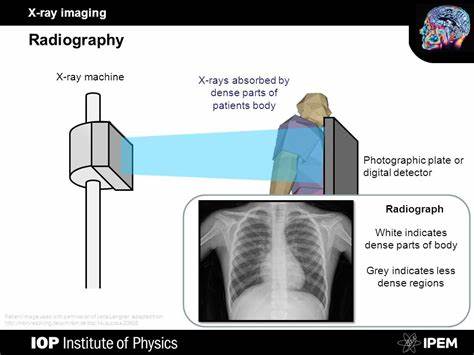 How did X-Rays gain mass adoption?