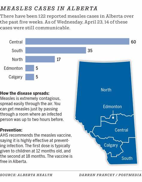 Measles 'out of control,' experts warn, as Alberta case counts surpass 1k