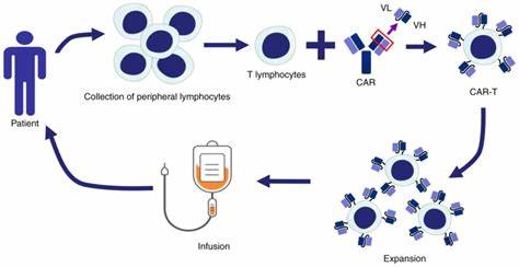 Johnson & Johnson CAR T Therapy Shows 80% Response in Lymphoma Trial