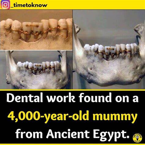 Ancient Species' Dental Records Can Offer Greater Clarity on Prehistoric Life